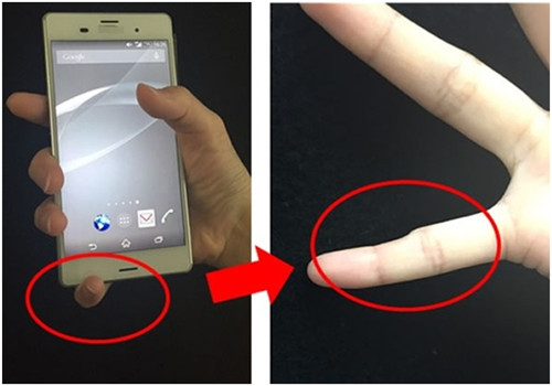 长期用手机会让小指变形？