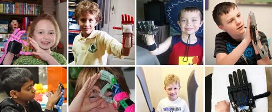 世界正在关注 为残疾儿童装上钢铁侠的手