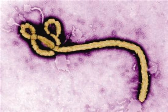 埃博拉病毒可在康复者精液中存活9个月