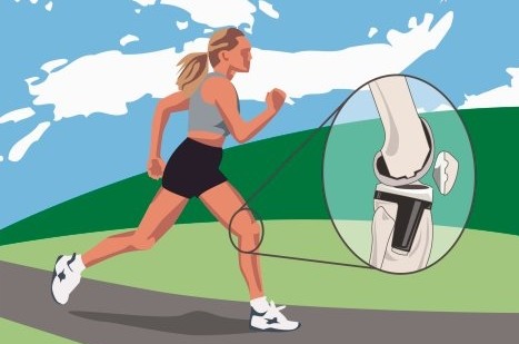 运动后 肌肉酸痛怎么办？