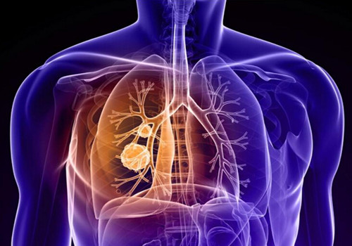 日研究人员发现肺癌细胞转移机制