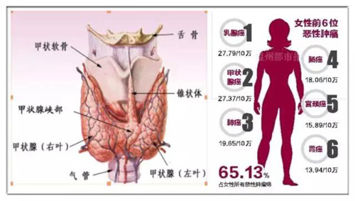 [中国医大四院]2月27日将办甲状腺大型义诊