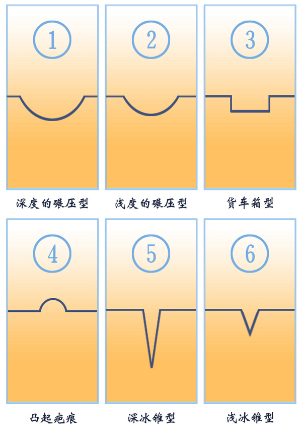 十几年的痘疤可以修复吗