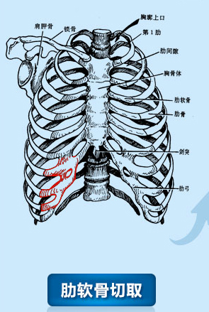 耳廓畸形的分类及治疗措施综述