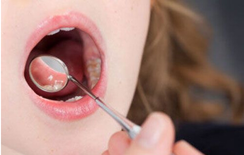 嘴巴苦味中医看法 嘴巴苦味可以吃的食疗方