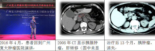 实践"中国式抗癌"（一）：胰腺癌治疗