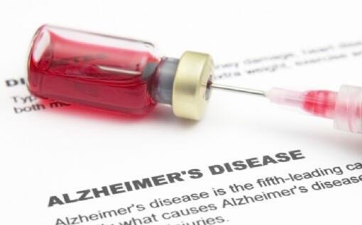 抗体疗法减少阿尔茨海默病淀粉样蛋白斑块