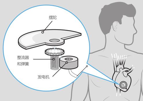 无需电池的 自动心脏起搏器