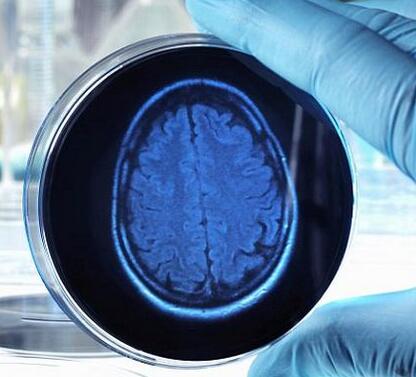 科学家实验室培育出数百个微型人类大脑：迷你“类器官”