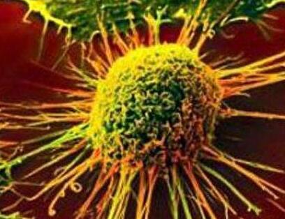 Oncotarget：突破！中澳科学家揭秘传统中药苦参注射液如何杀灭癌细胞？