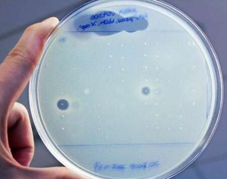 科学家从人体细菌基因组中发现两种新型抗生素
