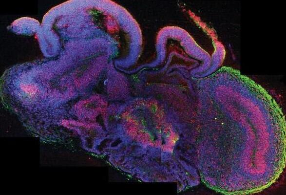 科学家或很快培育出能思考和感知的人造大脑