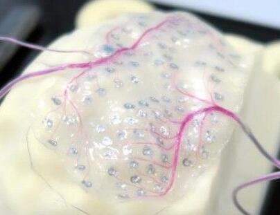 日本将研发在大脑植入电极解救“渐冻人”技术