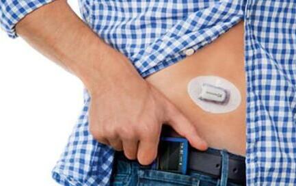 FDA批准首个连续血糖监测系统
