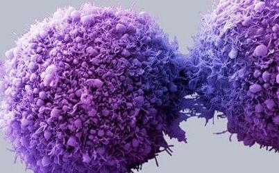 研究者研发纳米盘体系 提供个性化的癌症治疗方案