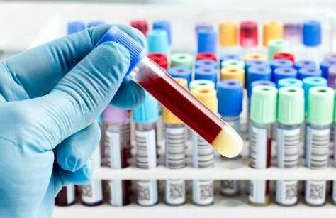2016下半年血液检测研究进展一览