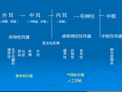 了解耳聋基本知识 利于精准防治  