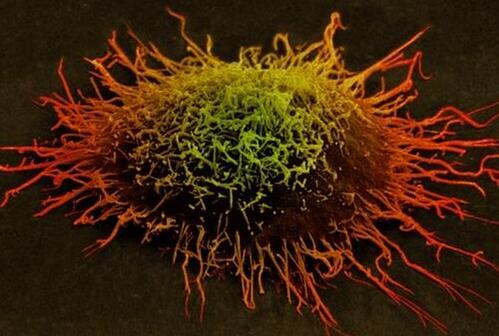 绘制人类机体细胞地图集 为癌症及其它疾病研究带来革命性突破