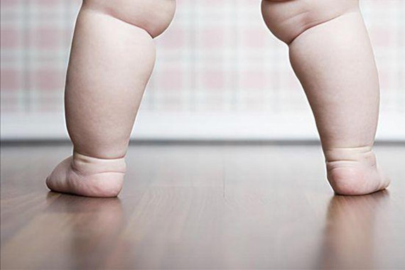 肥胖让肾脏“很受伤”儿童肾病需坚持治疗