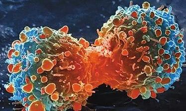 Redox Biol：揭示高剂量维生素C杀死癌细胞机制