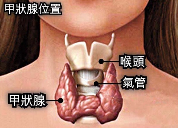 预防甲状腺结节长成癌