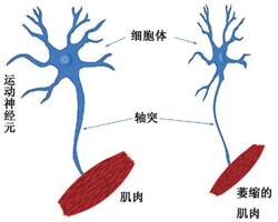 人类皮肤细胞直接变身运动神经元