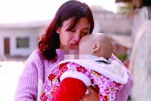 女童脸上长肿瘤 北京好心人援助